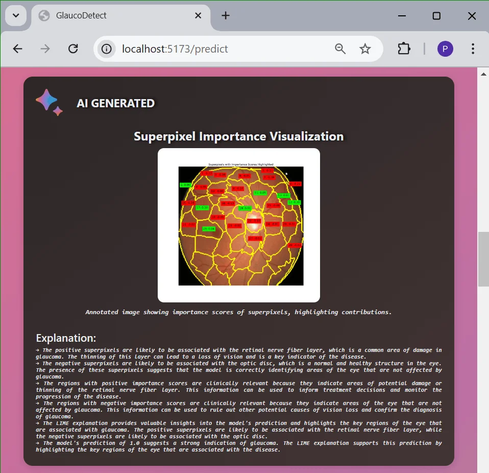 Explainable AI-Based Glaucoma Detection preview 6 of 6