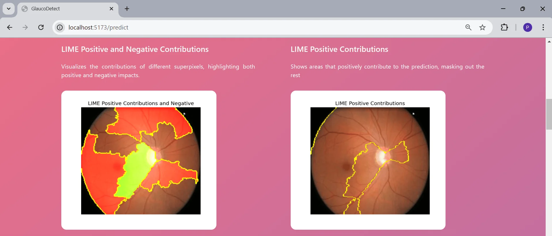 Explainable AI-Based Glaucoma Detection preview 4 of 6