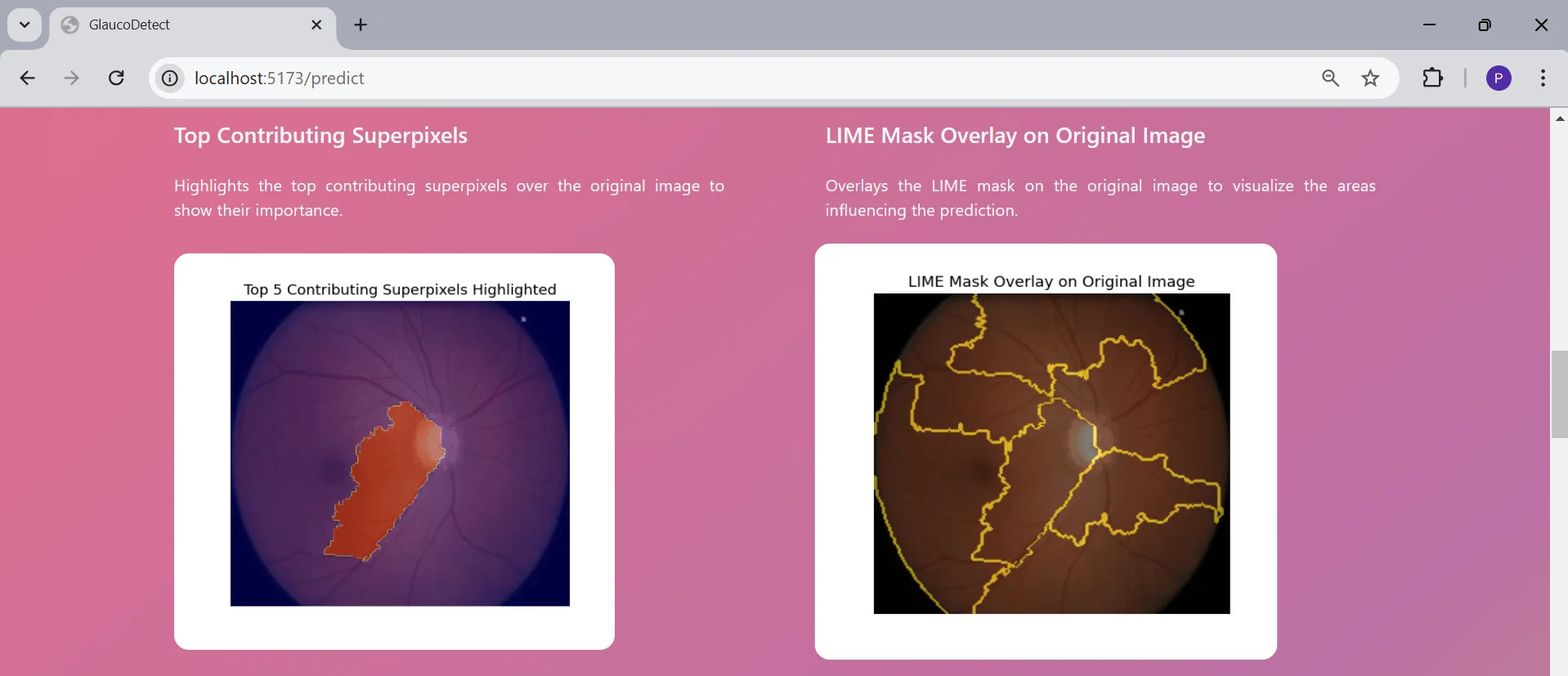Explainable AI-Based Glaucoma Detection preview 5 of 6
